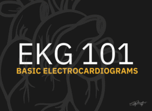 EKG 101 - Basic Electrocardiograms