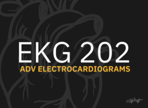 EKG 202 - Advanced Electrocardiograms